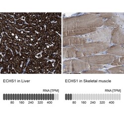 ECHS1 Antibody, Novus Biologicals 25 &mu;L | Buy Online | Novus Biologicals | Fisher Scientific